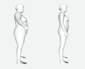 Mounjaro / Wegovy with > 5st / 30kg to lose: Thread 3