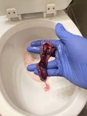 Can someone tell me if this was a miscarriage? :(