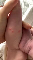 Anyone know what this rash could be