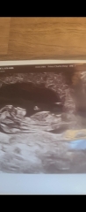 Gender guesses please