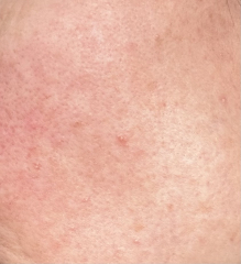 What are these spots?