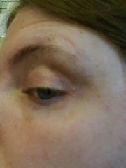 White dots on face