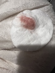 TW- Blood. Had anyone had a similar situation?