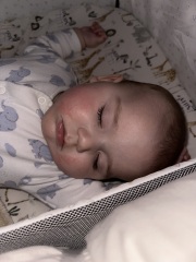 Rash - is it allergy? Ezcema? Or teething?