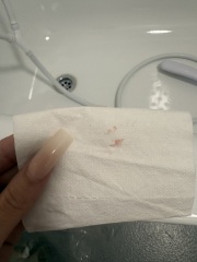 Implantation bleeding?