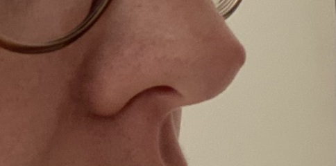 To want to chop off my unsightly nose