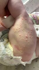 Anyone know what this rash could be