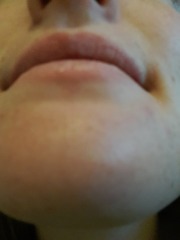 White dots on face