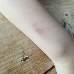 No paediatric rheumatologists in our health board 😫