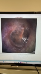 Bought an ear camera PICS