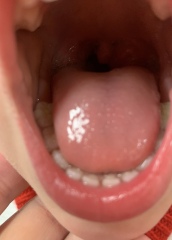 Tonsils picture please help!