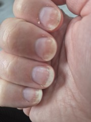 Help with nails