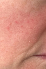 What are these spots?