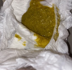 3 month old diarrhoea- Advice please