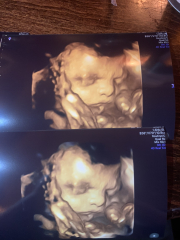 Due February 2025 - Thread 4