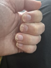 Help with nails