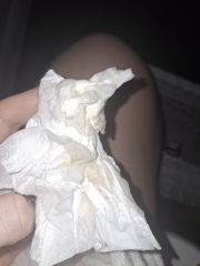 6dpo spotting cramping
