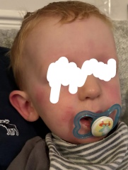 Strep Throat/Scarlet Fever..or just viral illness