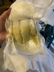 Warning! Poo Pics - is this normal?