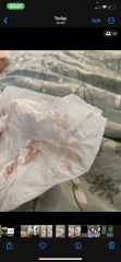 Implantation bleeding
