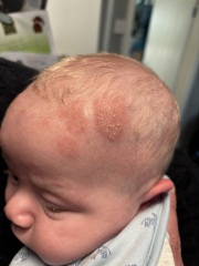 What is this on my sons head???
