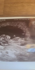 Gender guesses please