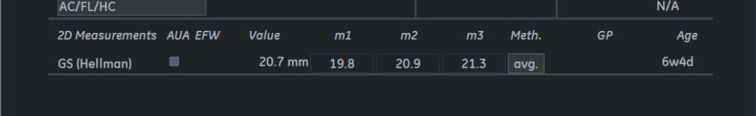 What’s this on my scan?
