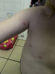 Help! Red pus spots on 5 year old