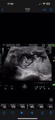 Gender Scan 15 weeks!! Please ease my mind!!