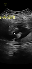 Thoughts on this scan?