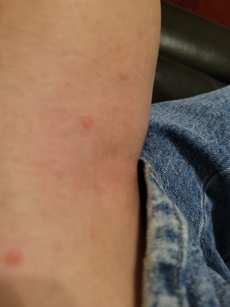 What bite is this?