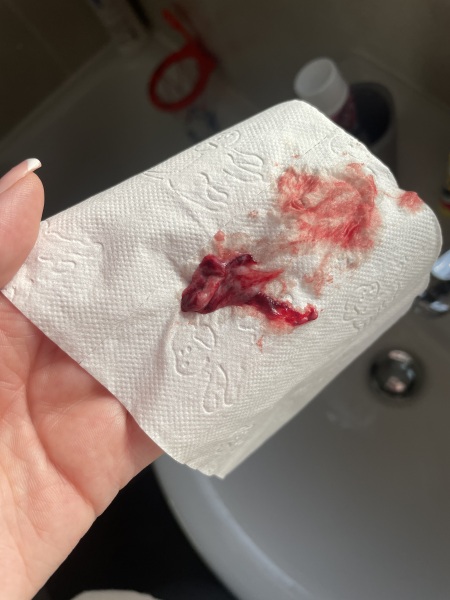 TW/ Possible miscarriage?