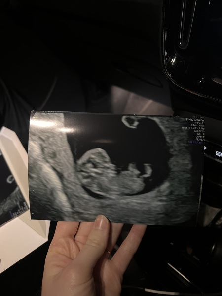 Due July 25 - Thread 2 - Approaching the 12 week scans!