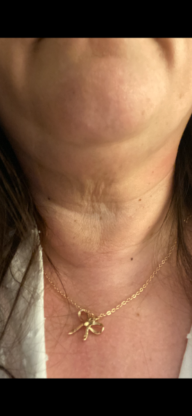 Crepey neck help please!