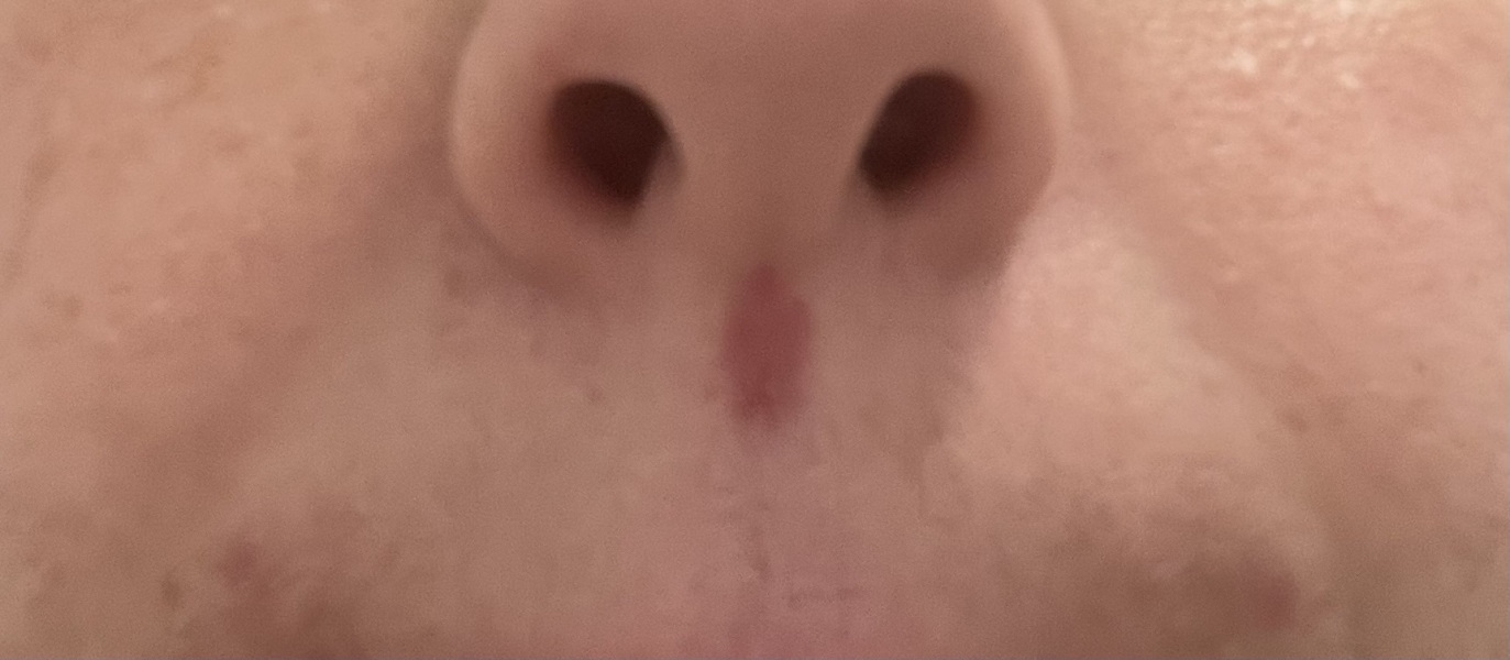 Mark under nose