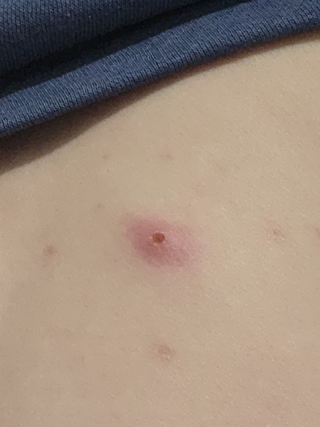 Any ideas, painful and been a while
