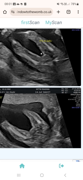 Can any sonographers give their input on this early gender scan?