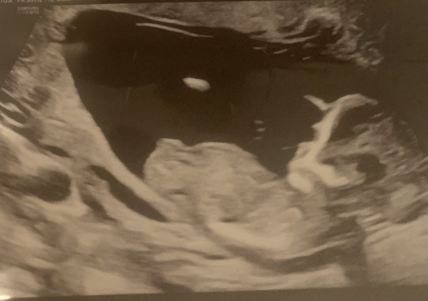 Gender guess please?!