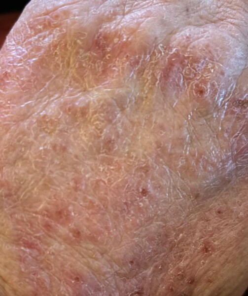What is this on my hand???