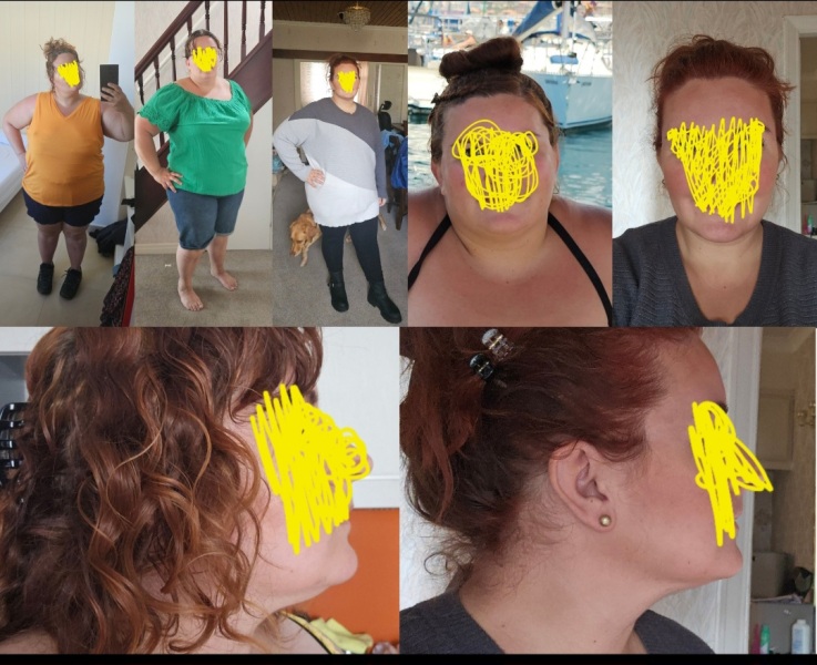 Mounjaro August starters thread 9 (OMG)