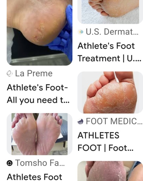 What’s going on with my feet?! (Photo included) *Trigger* looks grim