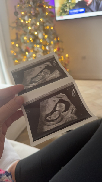 4 weeks 6 days, due 9 July 2024.. anyone wanna join?