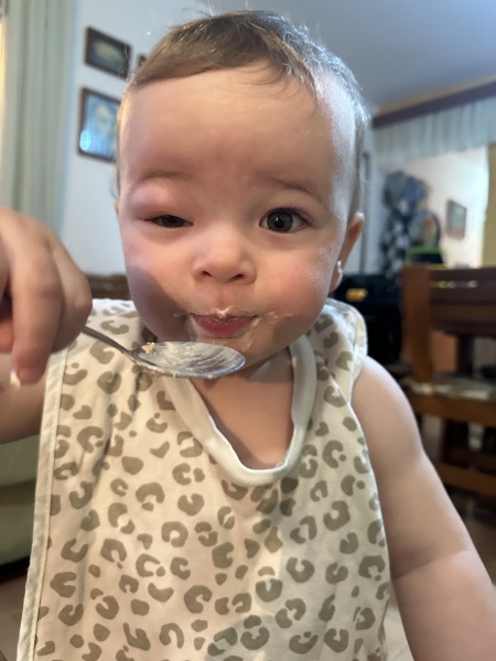 Anyone’s toddler had swollen eyelids like this?