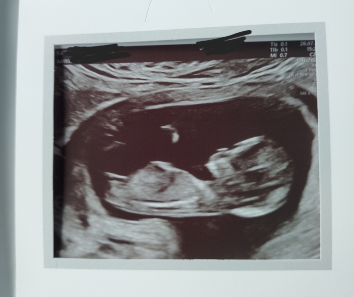 Nub theory pros, is this definitely a boy…?