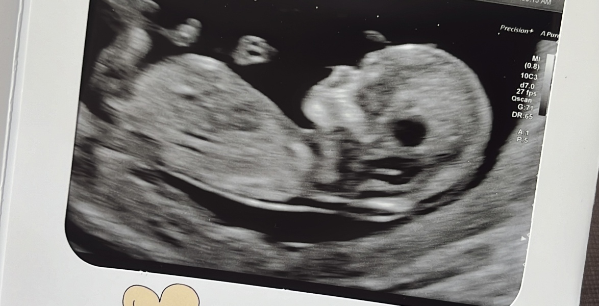 Nubologists question - any experiences?