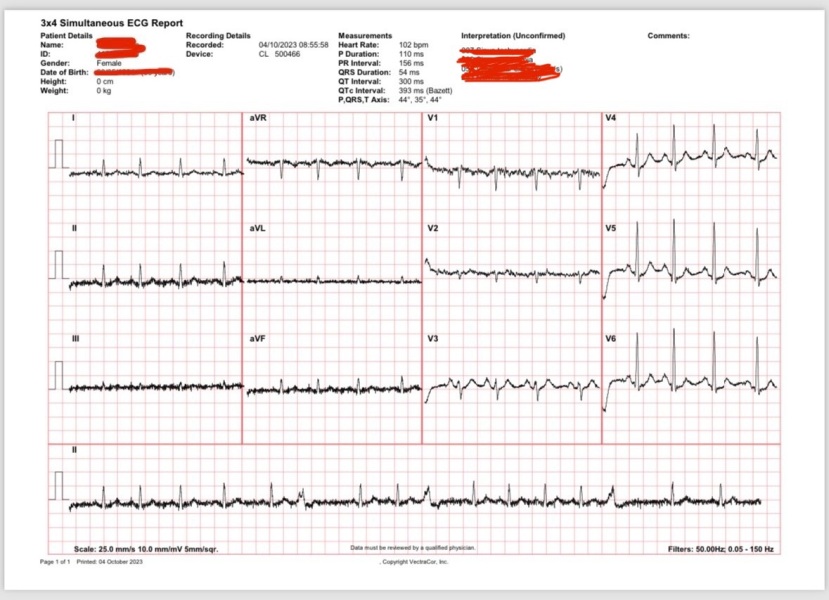 ECG interpretation