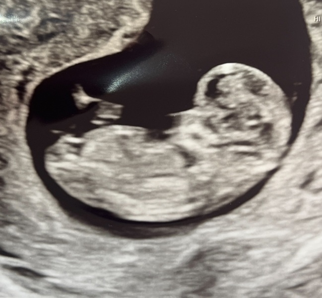 Boy or girl