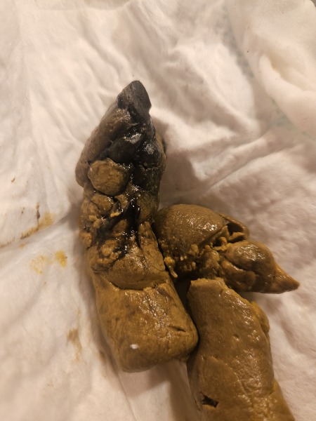 Black baby poo [contains pic - content warning added by MNHQ]