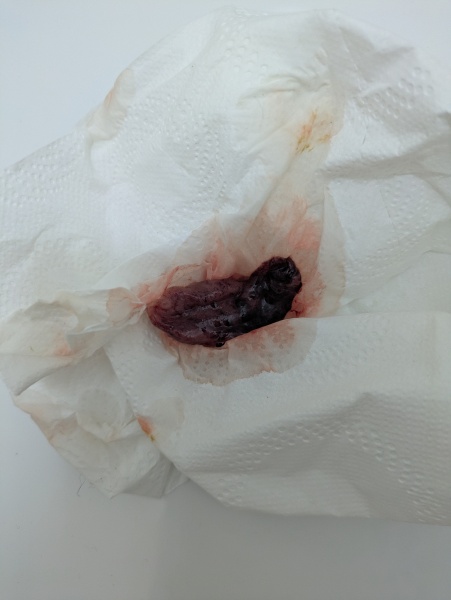 Just passed a medium sized clot(?) photo warning