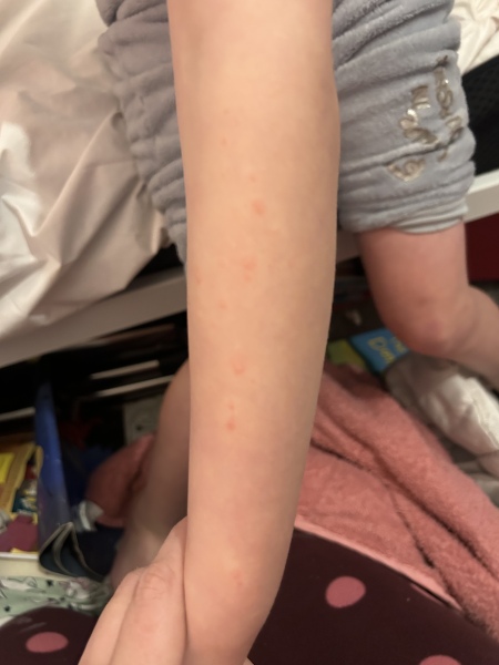 Bed bugs?!